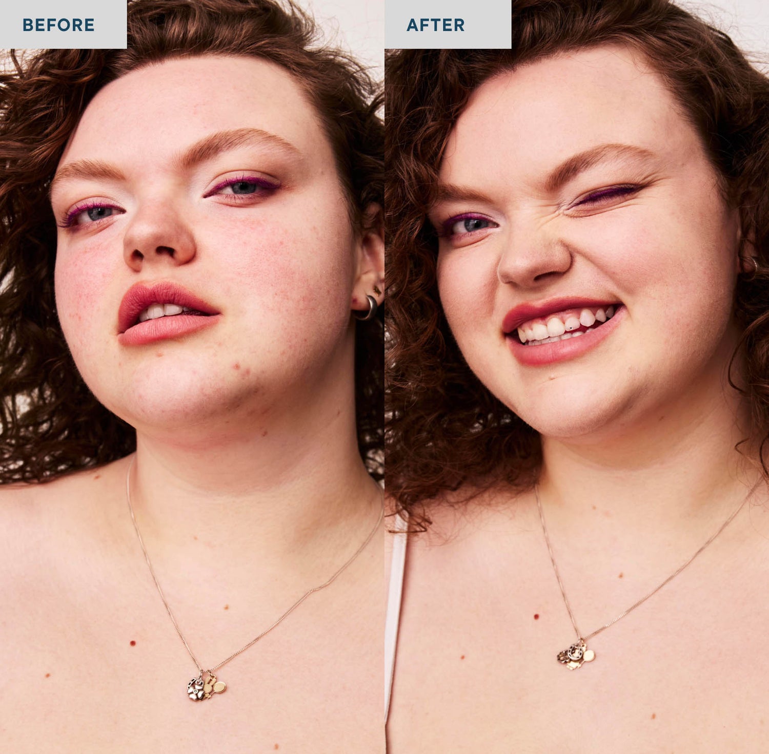 Two photos of a woman with curly brown hair on a white background and wearing a top with white spaghetti straps and a gold necklace. The lefthand photo is labeled &quot;before&quot; and she is not wearing concealer on her skin, which shows some blemishes. The righthand photo is labeled &quot;after&quot;, and she is wearing SPATCH invisible powder spot fix, which covers her skin imperfections. 