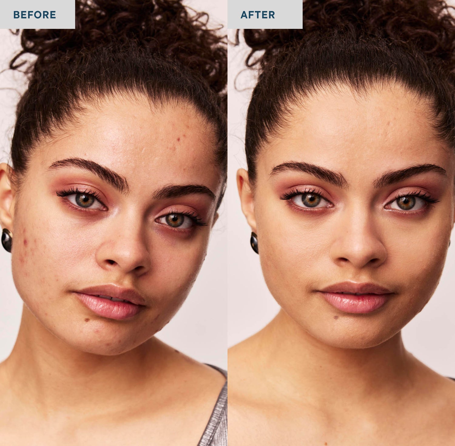 Two photos of a woman with curly brown hair on a white background and wearing a earrings and pink eyeshadow with her hair pulled in a high ponytail. The lefthand photo is labeled &quot;before&quot; and she is not wearing concealer on her skin, which shows some blemishes. The righthand photo is labeled &quot;after&quot;, and she is wearing SPATCH invisible powder spot fix, which covers her skin imperfections. 